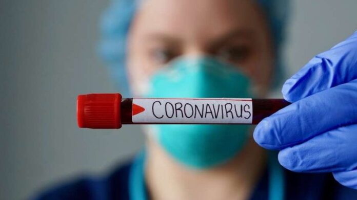 coronavirus_servidores_790x444_06082020125252