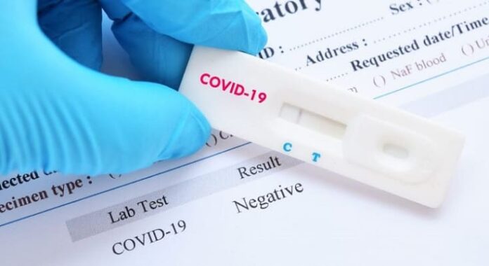 teste-rapido-coronavirus-covid19