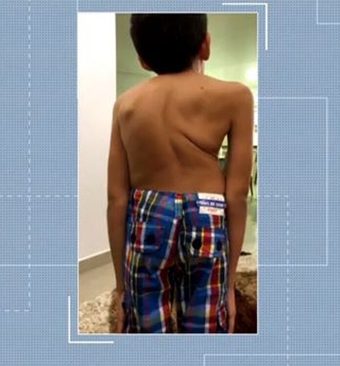 equipamento-hij-paciente-1