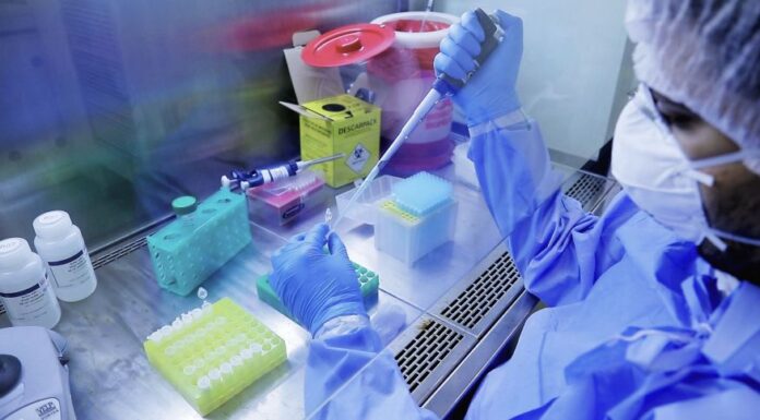 diagnostico_novo_coronavirus_fiocruz_covid_19-15