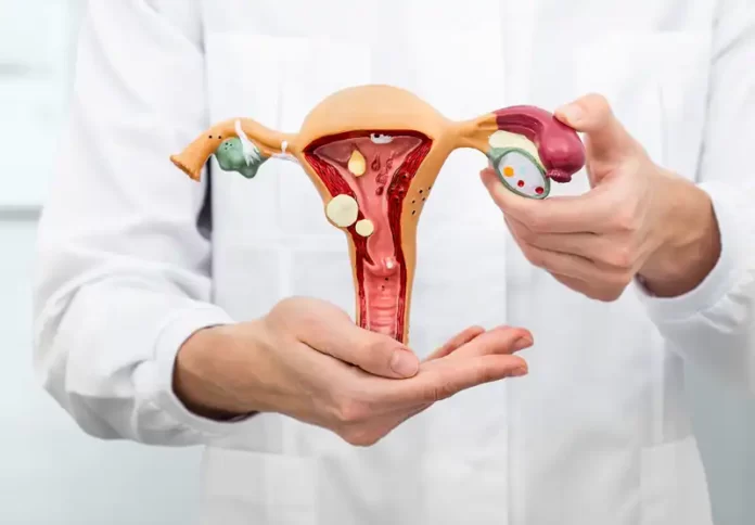 cancer-no-utero-saiba-quando-a-doenca-necessita-de-cirurgia