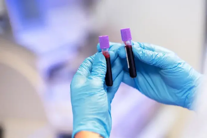 cd8c7a57-0ddb-4f7a-bfd5-83d0095c0532