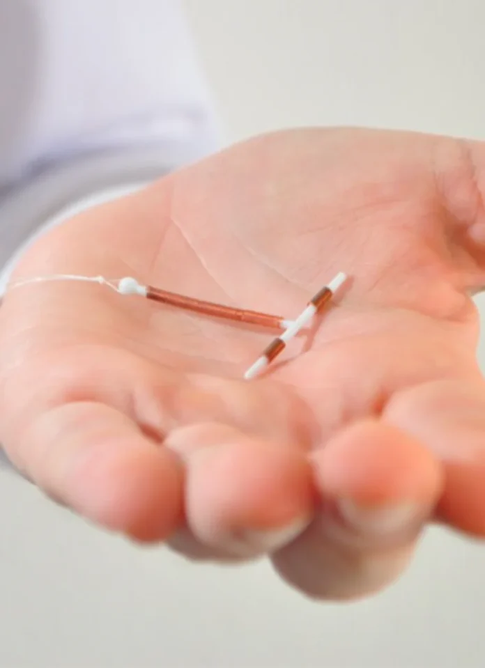 implante-de-diu-fc25