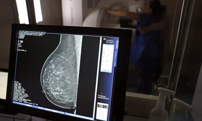 Outubro Rosa Pacientes com câncer de mama têm benefícios Tela de monitor exibindo o resultado de uma mamografia, com o equipamento e a paciente ao fundo, ilustrando o diagnóstico e os benefícios para pacientes com câncer de mama no Outubro Rosa.