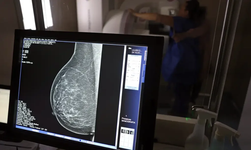 Outubro Rosa Pacientes com câncer de mama têm benefícios Tela de monitor exibindo o resultado de uma mamografia, com o equipamento e a paciente ao fundo, ilustrando o diagnóstico e os benefícios para pacientes com câncer de mama no Outubro Rosa.