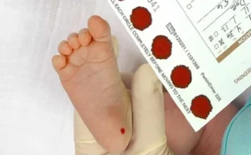 Balneário Gaivota descentraliza coleta do Teste do Pezinho Profissional de saúde coletando gotas de sangue do pé de um bebê para a realização do Teste do Pezinho (Triagem Neonatal), em contexto de descentralização da coleta para as ESFs de Balneário Gaivota.