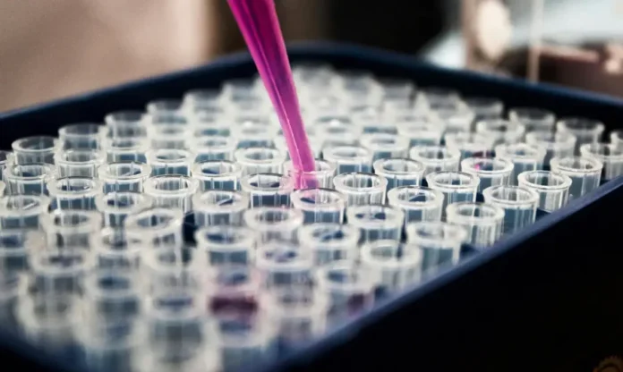 Cérebro precisa inflamar para Alzheimer progredir Close-up de uma pipeta automática (ou micropipeta) dispensando um líquido (solução) em uma placa de microplacas com vários microtubos transparentes, simbolizando o trabalho de pesquisa laboratorial com biomarcadores ultrassensíveis que identificaram o papel da inflamação (microglia e astrócitos) na progressão do Alzheimer.