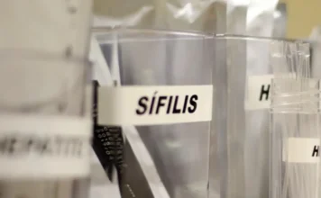 Sífilis tem avanço preocupante no Brasil