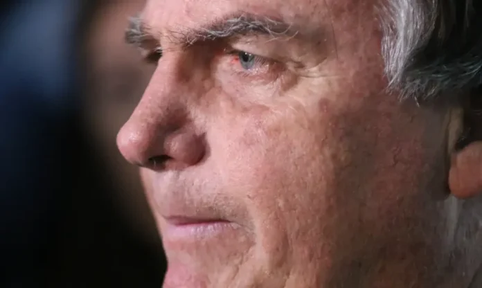 Bolsonaro volta ao centro cirúrgico após nova crise de soluços Close do ex-presidente Jair Bolsonaro. Paciente realiza terceiro bloqueio de nervo frênico em Brasília após nova crise de soluços; médicos programam endoscopia digestiva para esta quarta-feira.
