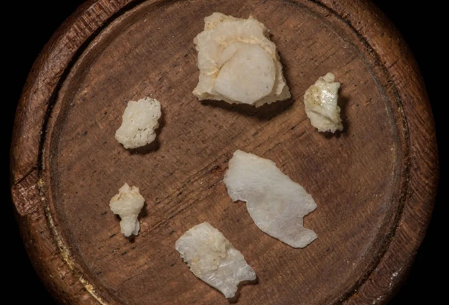 Fragmentos do crânio de Abraham Lincoln, em pedaços esbranquiçados, dispostos sobre uma bandeja de madeira escura.