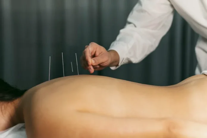 Acupuntura é regulamentada no Brasil com vetos do governo Profissional de saúde inserindo agulha de acupuntura nas costas de um paciente durante sessão de tratamento terapêutico.