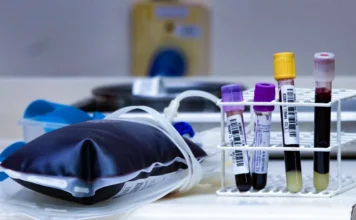 HEMOSC convoca doadores para iniciar 2026 salvando vidas "Bolsa de sangue para transfusão e suporte com tubos de amostras sanguíneas sobre bancada laboratorial, ilustrando o processo de coleta e doação no HEMOSC."