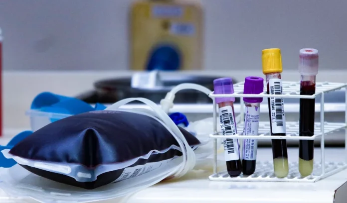 HEMOSC convoca doadores para iniciar 2026 salvando vidas "Bolsa de sangue para transfusão e suporte com tubos de amostras sanguíneas sobre bancada laboratorial, ilustrando o processo de coleta e doação no HEMOSC."