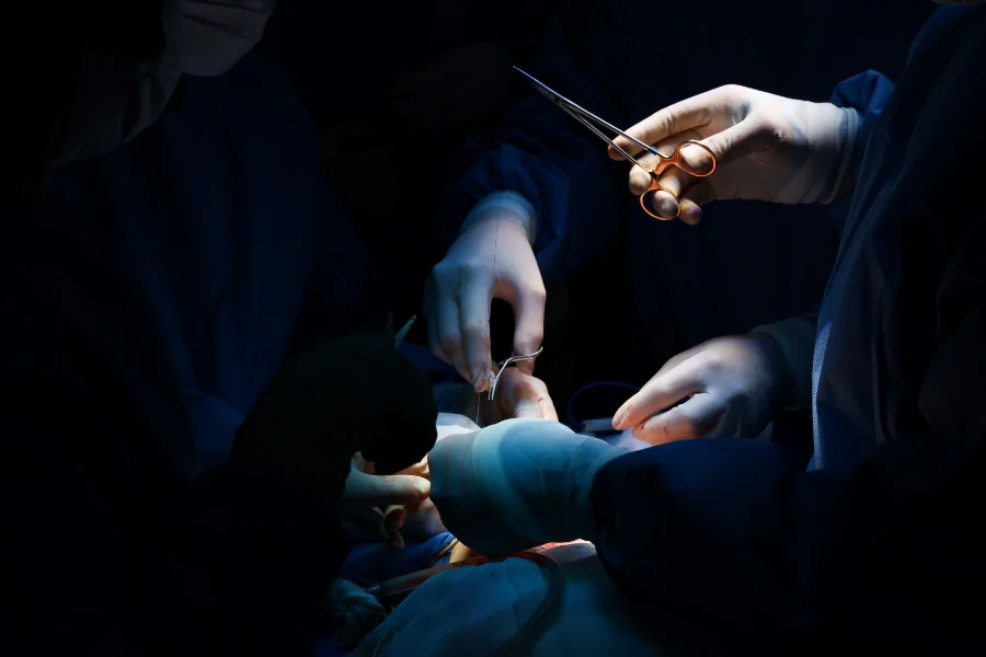 Close nas mãos de uma equipe médica utilizando instrumentos cirúrgicos durante um procedimento, ilustrando a realização de três transplantes renais no Hospital São José, em Criciúma.