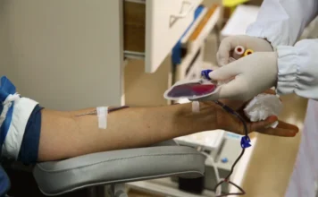Alesc inicia análise de novos projetos de lei em SC Foto em close-up do braço de um doador em procedimento de doação de sangue em Santa Catarina, com agulha e bolsa de coleta visíveis. Imagem ilustra o projeto de lei da Alesc (PL 153/2026) sobre incentivos fiscais para doadores regulares de sangue.