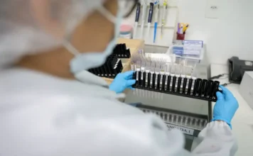Novo método da Fiocruz pode ampliar combate à malária Pesquisador em laboratório analisa amostras em estudo da Fiocruz sobre novo método de tratamento contra malária resistente