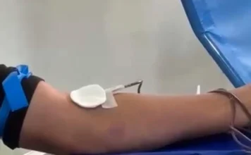 Timbé do Sul organiza nova doação de sangue Doação de sangue realizada por voluntário durante ação mensal organizada em Timbé do Sul com encaminhamento ao Hemosc de Criciúma.