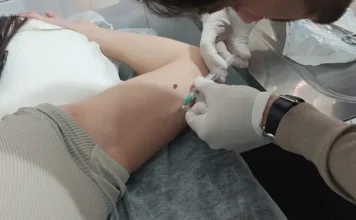 Torres amplia oferta de implante contraceptivo no SUS
