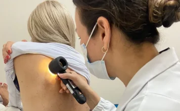 Junho Preto alerta para prevenção do melanoma em SC