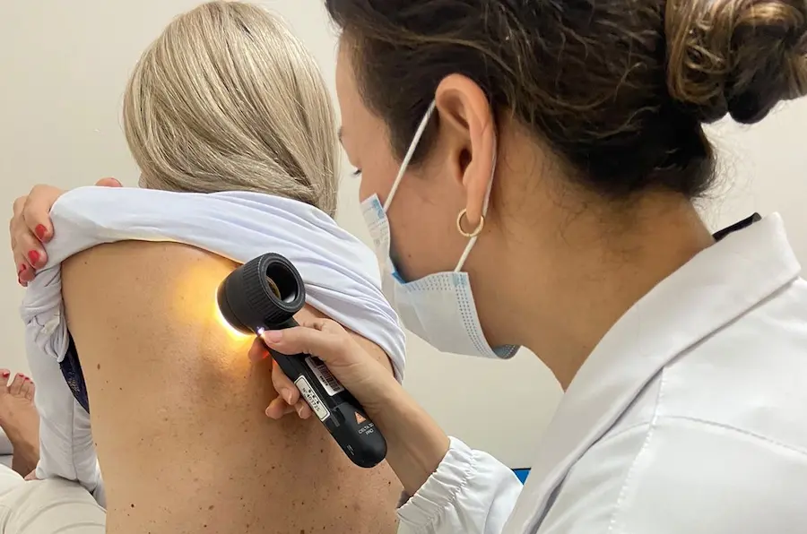 cepon-melanoma-2