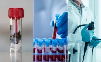 Novos exames ampliam prevenção do câncer colorretal