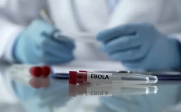 Oxford testa vacina contra cepa Bundibugyo do Ebola