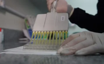Pesquisa da Unesc avança em testes para sífilis