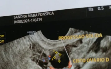 Mãe de filhos autistas pede apoio para recomeçar em Sombrio Imagem de ultrassom apresentada por Sandra durante investigação médica de cistos e alteração em ovário.