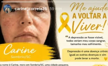 Moradora de Sombrio faz vaquinha para custear tratamento