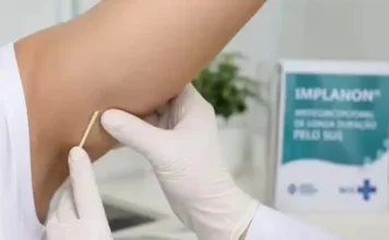 Anvisa amplia validade do implante contraceptivo para cinco anos